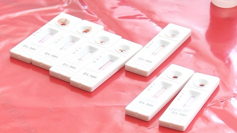 В Костанайской области отмечается рост распространения ВИЧ