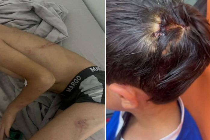 Избиение 8-летнего ребенка в Балхаше: правозащитники сообщили о новых деталях