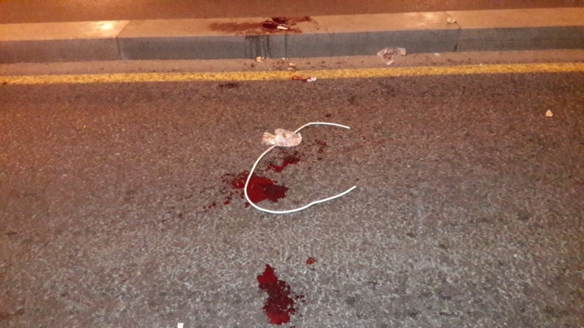 В Талгаре подросток порезал ученика колледжа