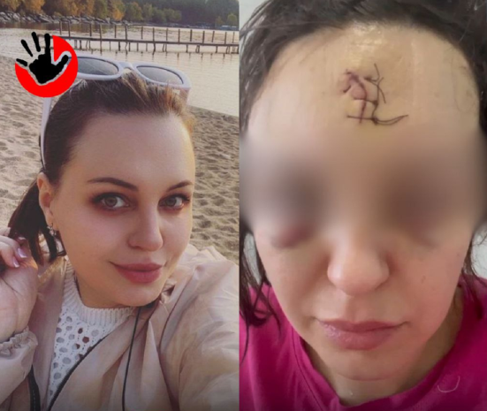 «Бил по голове кастетом»: покушение на убийство совершено в Астане