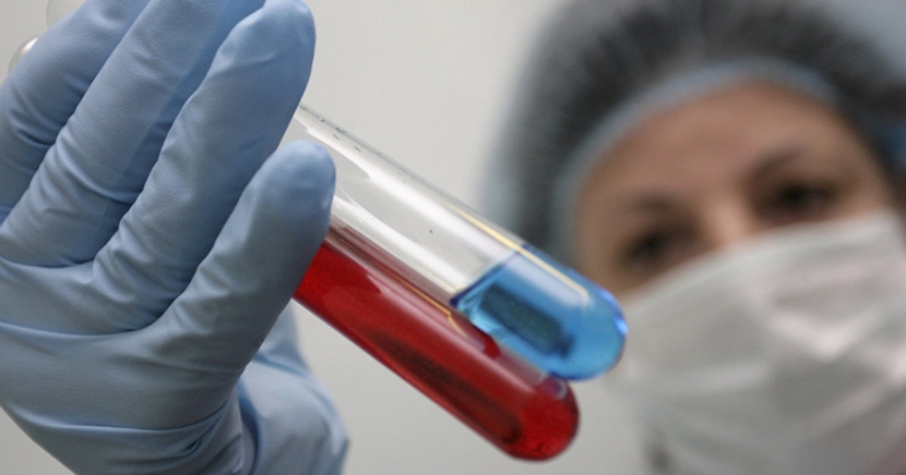 27-летний мужчина скончался от менингита в Кызылординской области