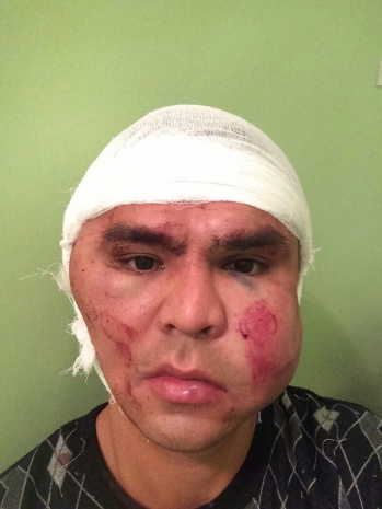 Стали известны новые подробности ЧП на озере в селе Шарбакты Павлодарской области