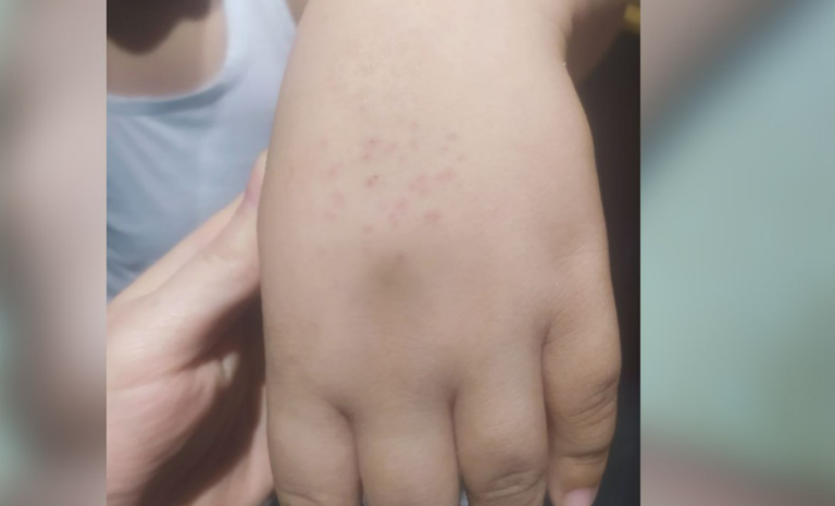 Учитель колола руки учеников иглой и саморезом в Узбекистане