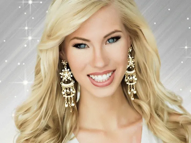 Девушка без руки стала королевой красоты