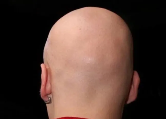 В Мозамбике произошли три ритуальных убийства лысых мужчин