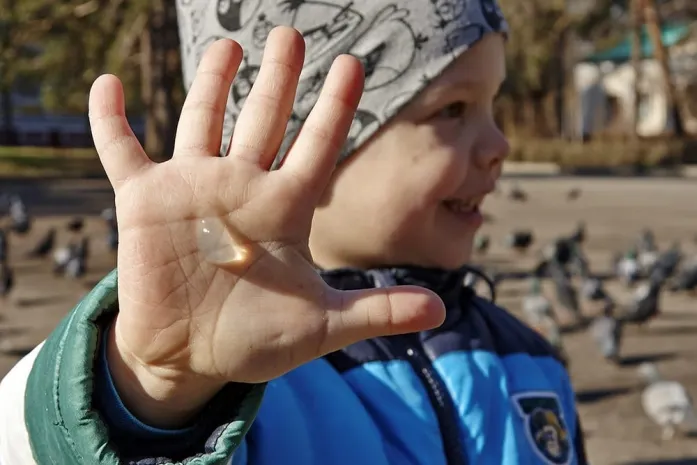 Необычная замена зеленке и йоду появилась в КазахстанеЭксклюзив