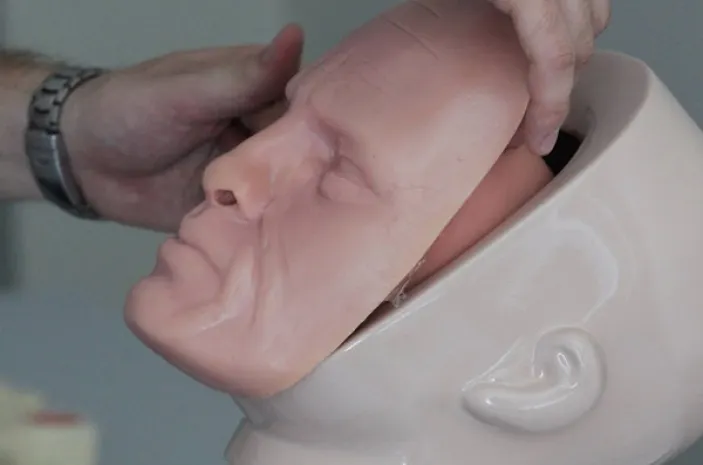 В Италии научились пересаживать человеческие головы