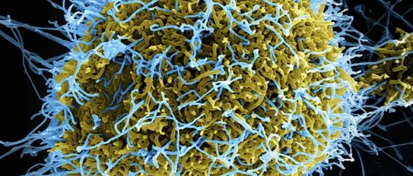 Новосибирские ученые разрабатывают вакцину против вируса Эбола