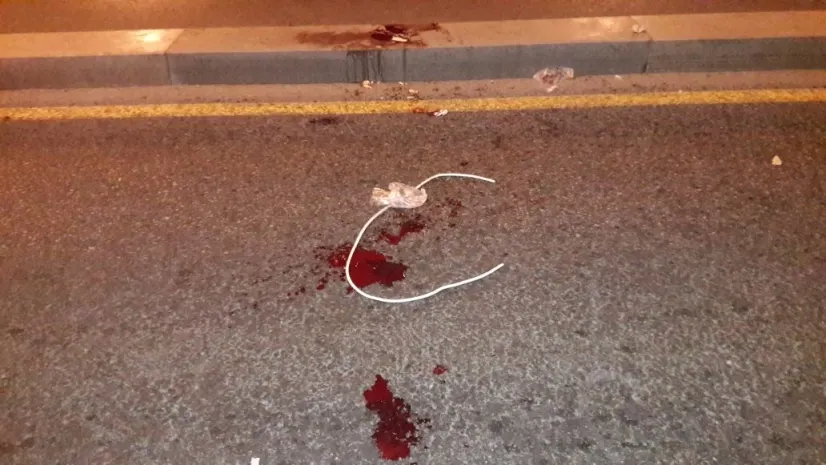 В Талгаре подросток порезал ученика колледжа