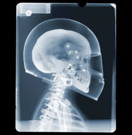 Внутренний мир: 30 удивительных рентгеновских фото