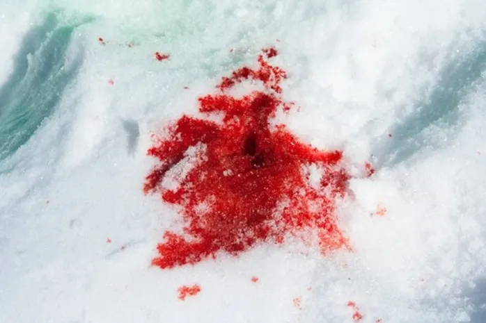 11-летнего подростка избили на улице Караганды