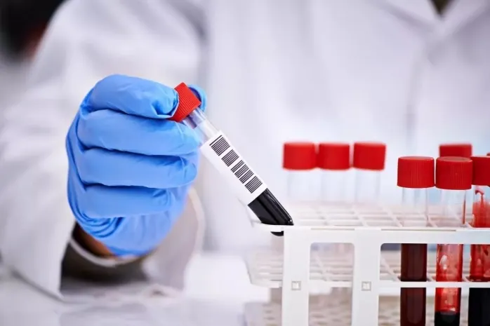 В Беларуси назвали сроки создания вакцины от COVID-19