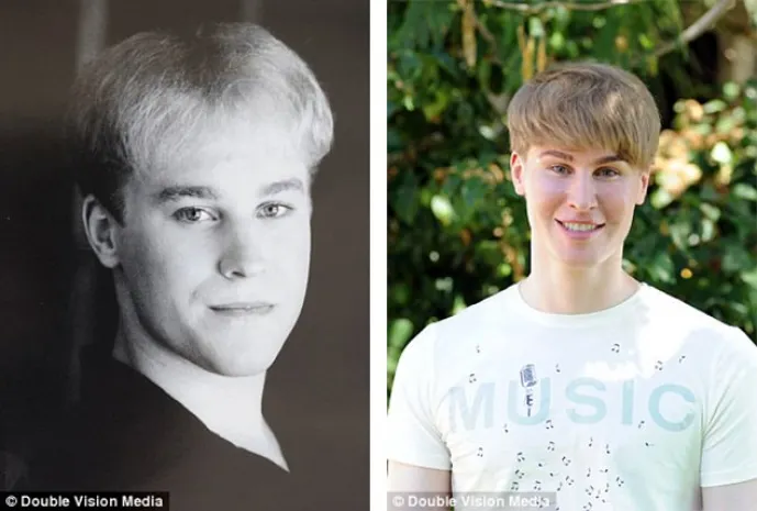 Американец купил себе лицо Джастина Бибера за $100 тысяч