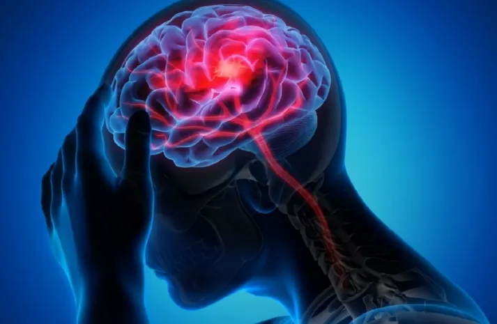 49 тысяч инсультов ежегодно регистрируется в Казахстане