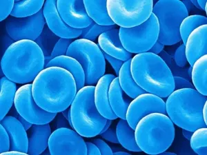 Вы у нас «голубых кровей»!