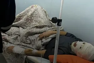 Бейнеу ауданындағы АЖС-да ер адам күйік алды