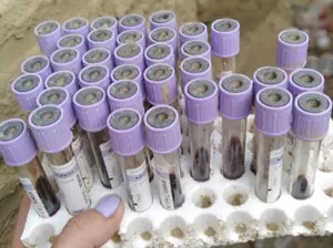 Свалку лабораторных пробирок с кровью обнаружили жители Актау