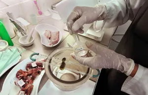 В Алматы зафиксирован больной с сибирской язвой