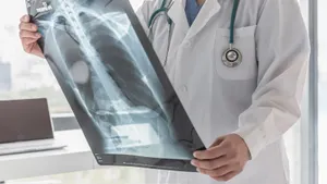 Рост заболеваемости туберкулезом зафиксирован среди студентов Астаны