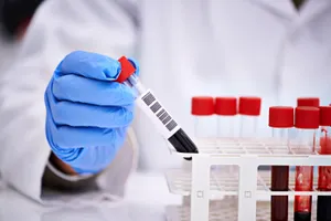 Вакцины загрязняют кровь – фейк