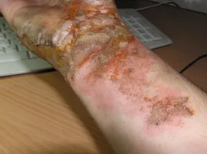 Нужна кровь для пострадавших в павлодарском пожаре