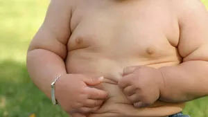 На Земле насчитали 124 миллиона детей, страдающих от ожирения