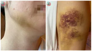 «Избивает жену и ребенка»: главу ТОО «Горкомхоз-Аксу» обвиняют в домашнем насилии