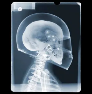 Внутренний мир: 30 удивительных рентгеновских фото