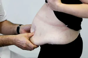 Медики предложат таблетку против ожирения