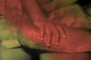 Как СССР помог победить главного врага человечества