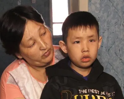 Мать пытается собрать деньги на глазной протез для 6-летнего сына