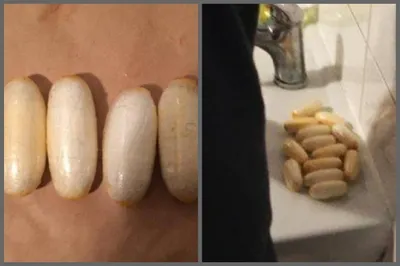 42 капсулы с кокаином пытался провезти в желудке казахстанец