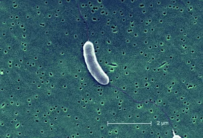 Попал в больницу с гриппом и лишился части кожи мужчина во Флориде