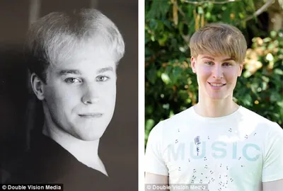 Американец купил себе лицо Джастина Бибера за $100 тысяч