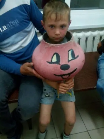 Гидравлические ножницы помогли снять котелок с головы мальчика