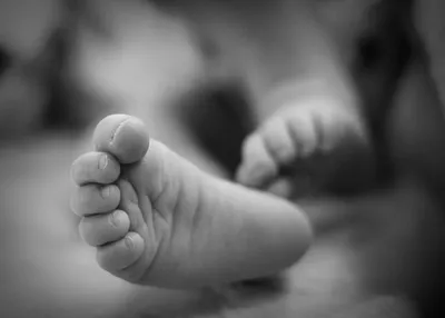 Восемь часов оперировали беременную женщину врачи из Актау и Атырау