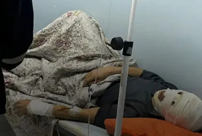 Мужчина получил ожоги на АЗС в Бейнеуском районе