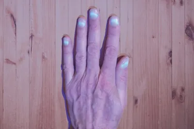 Эффект свечения ногтей зафиксирован у переболевших COVID-19