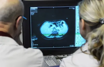 Ученые получат препарат для лечения рака на поздних стадиях