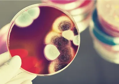 Об эпидемии «черной плесени» объявили в Индии