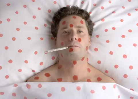 В США столкнулись с крупнейшей вспышкой кори за последние 20 лет