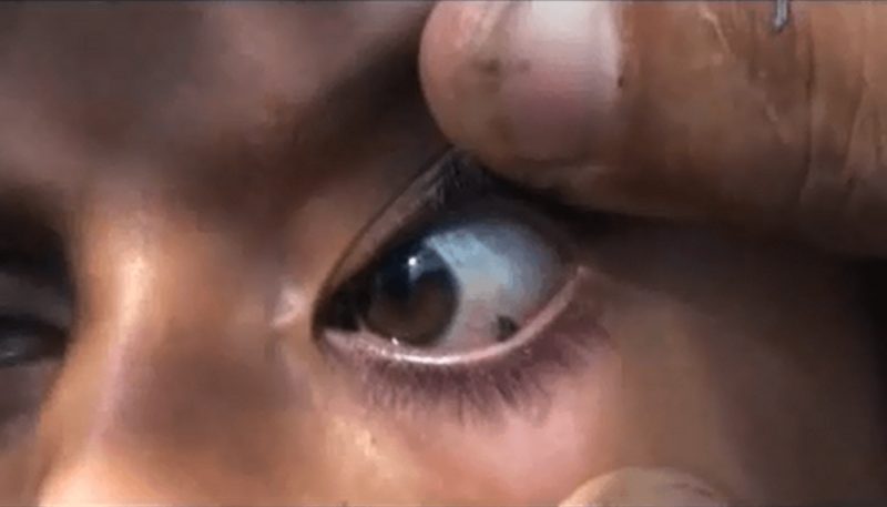 Девочка из Йемена плачет камнями. Видео