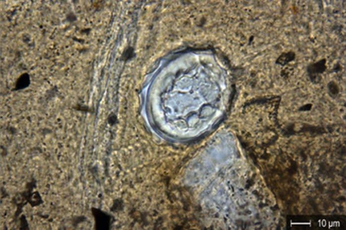 Археологи узнали о совместной жизни древних кельтов и паразитов