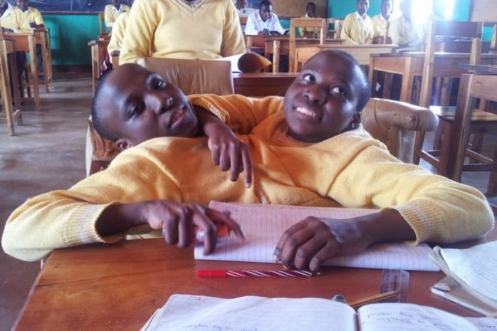 В Танзании скончались известные сиамские близнецы