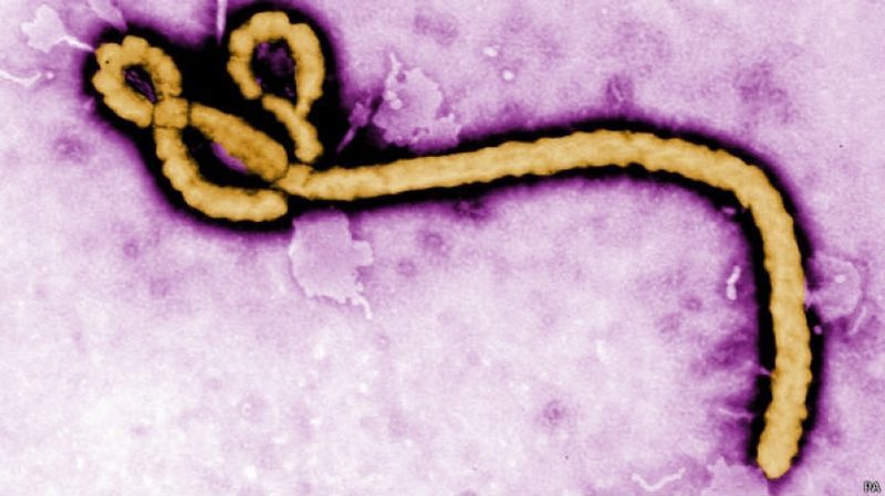 Ученые приступают к испытаниям новой вакцины от Эболы