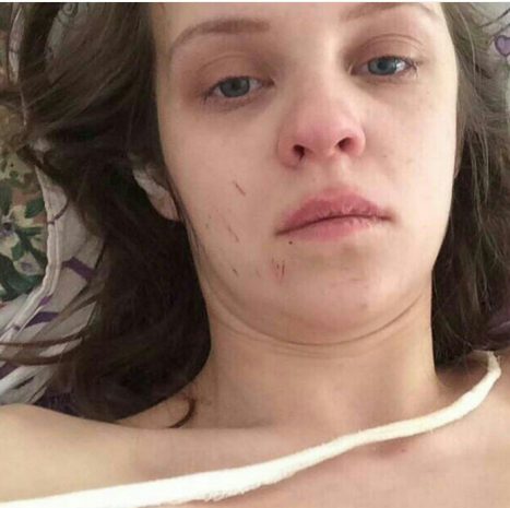 ЧП с батутом в Павлодаре: женщина с тяжелыми травмами попала в реанимацию