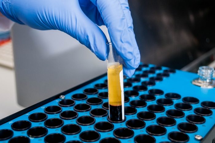 Арабские ученые достигли инновационного прорыва в лечении COVID-19