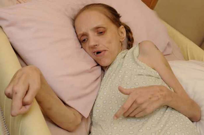 Пиво превратило женщину в живой труп