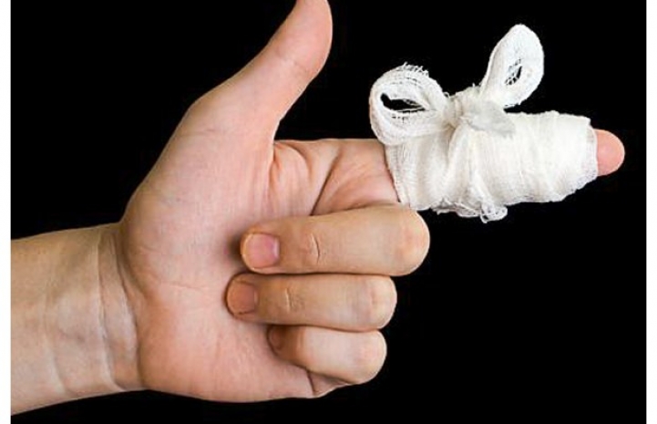 Казахстанец отсудил почти 150 тысяч тенге за укушенный палец