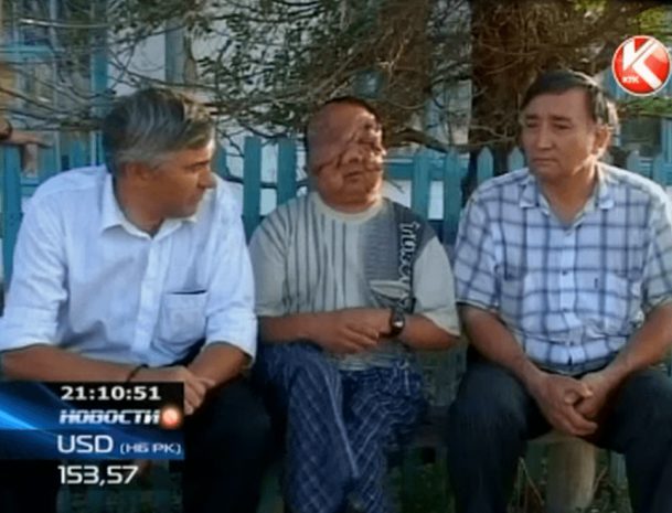 Жертва ядерных взрывов на Семипалатинском полигоне просит помощи